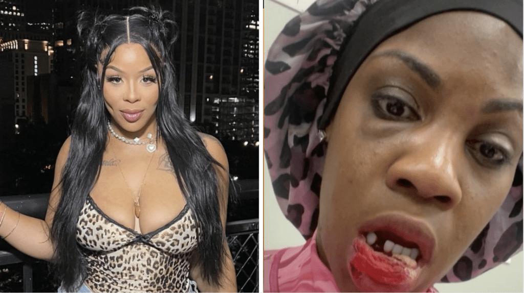 Tesehki e lë trupin pa dhëmbë diamantin pas një lufte shpërthyese në Baddies Caribbean Reunion!