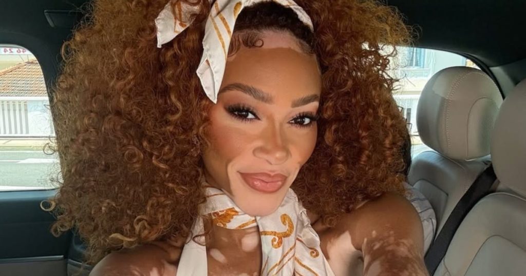 Tifozët e quajnë Winnie Harlow në veshje sauna me dy copë 'Sensational'