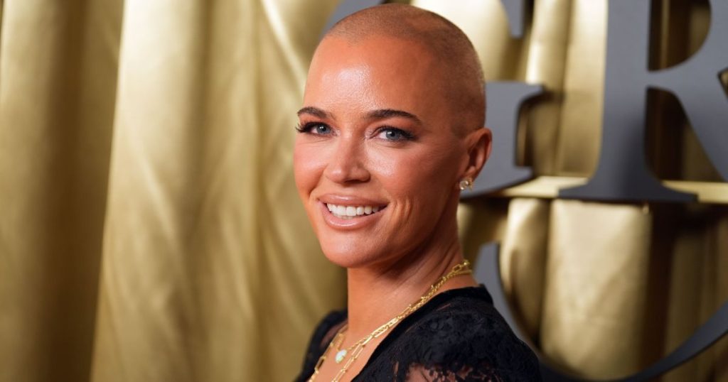 Teddi Mellencamp shtrohet në spital pasi mjekimi shkaktoi një gjendje potencialisht kërcënuese për jetën